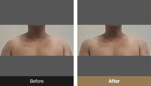 시술전후이미지