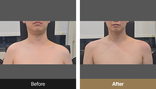 시술전후이미지