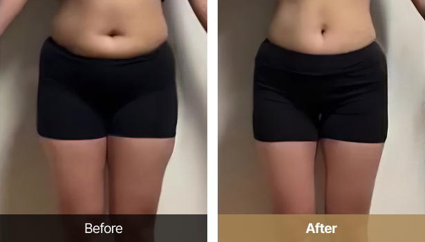 시술전후이미지