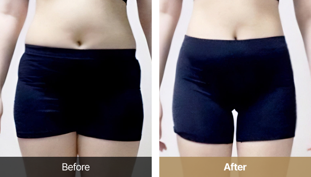 시술전후이미지