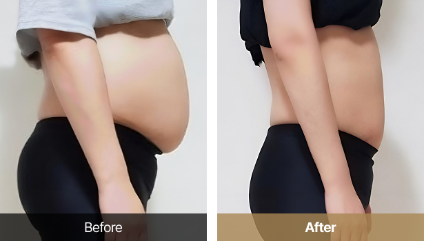 시술전후이미지