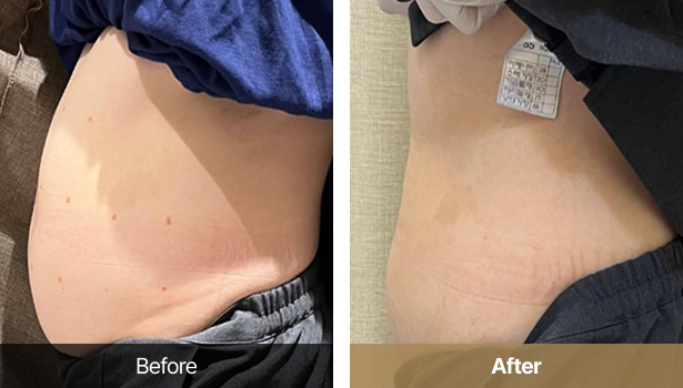 시술전후이미지