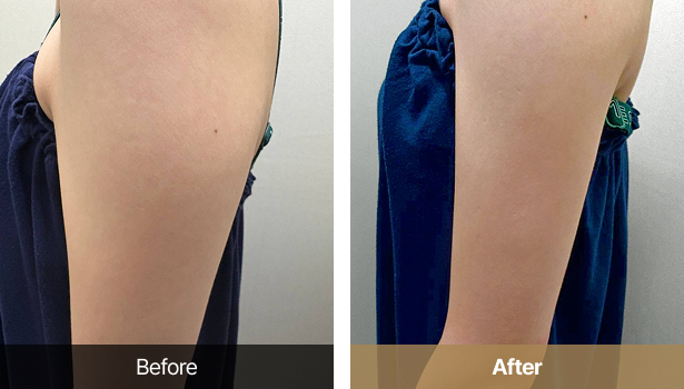 시술전후이미지