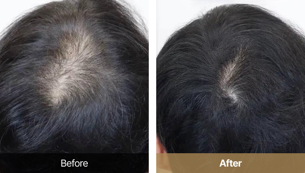 시술전후이미지