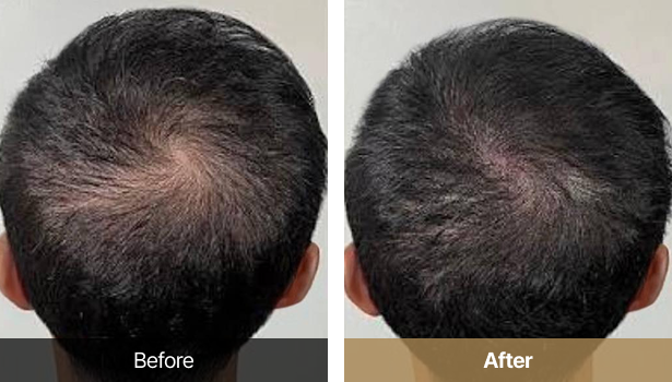 시술전후이미지