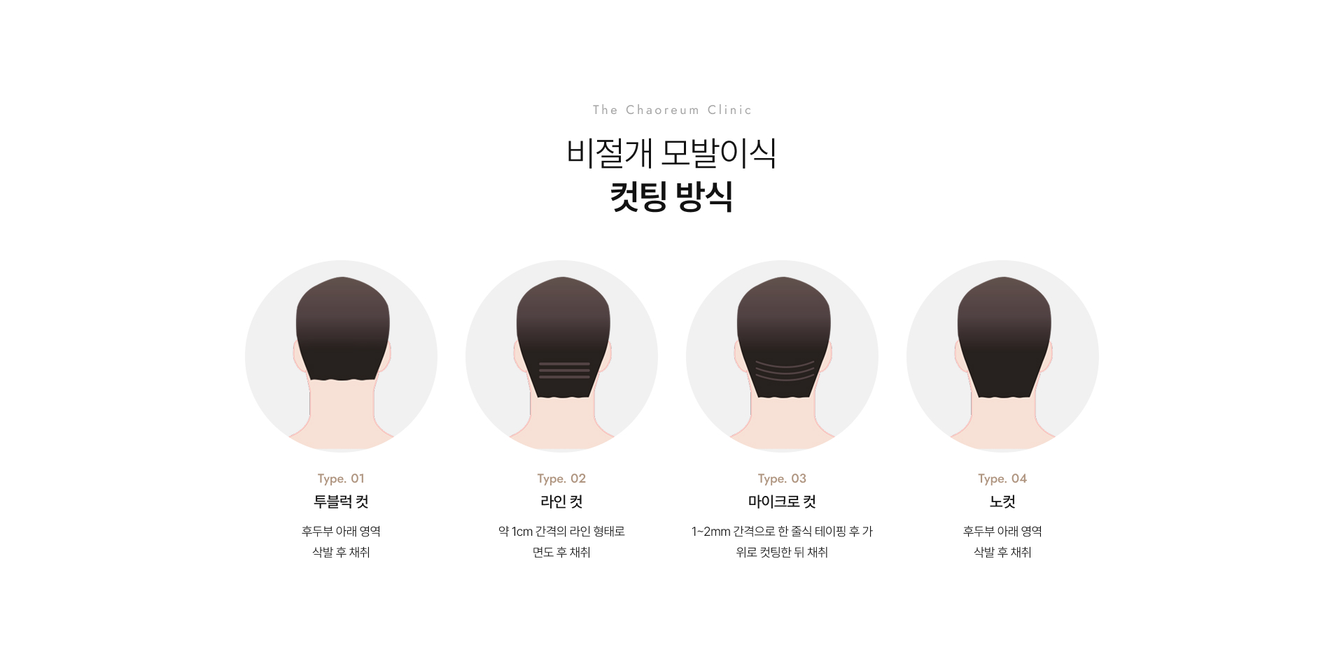 디자인모발이식 상세06