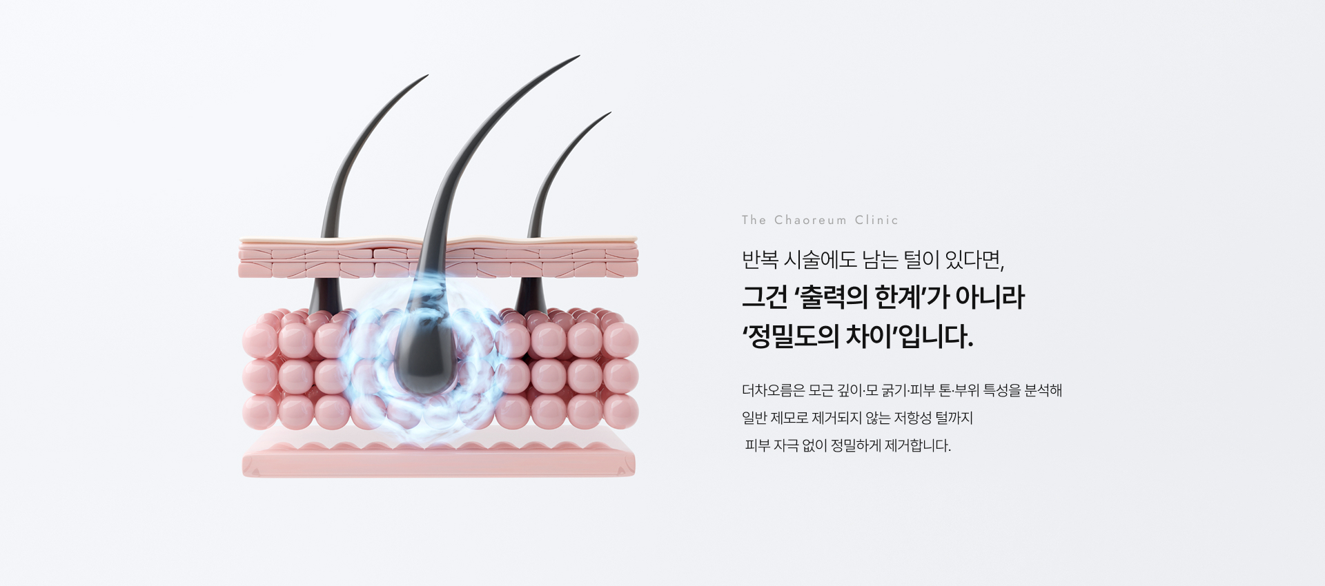 더차오름꼼꼼제모 상세05